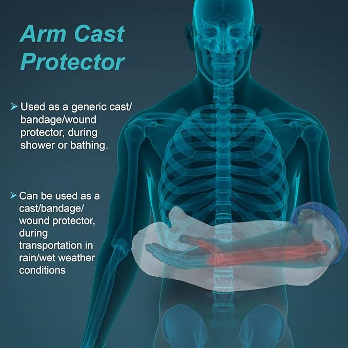 TYNOR CAST COVER FOR ARM