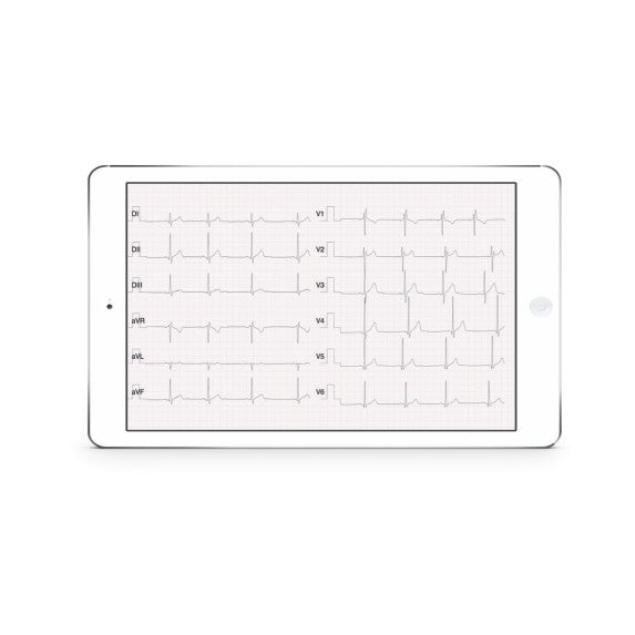 Oxymed D Heart Portable ECG Machine